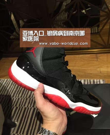 亚博入口_银屑病到南京哪家医院(图3) 亚博入口