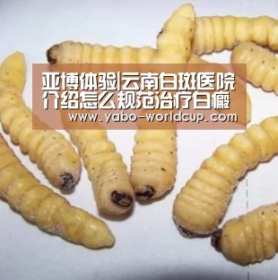 亚博体验|云南白斑医院介绍怎么规范治疗白癜风(图3) 亚博平台